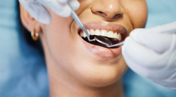 Best Walk-In Emergency Dentist in China Grove, NC