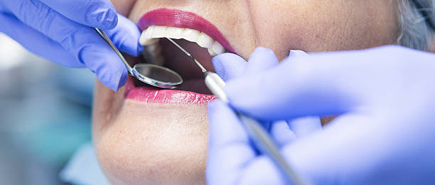 Best Weekend Emergency Dentist in China Grove, NC