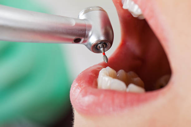 Best Emergency Dental Care for Trauma or Injury in China Grove, NC